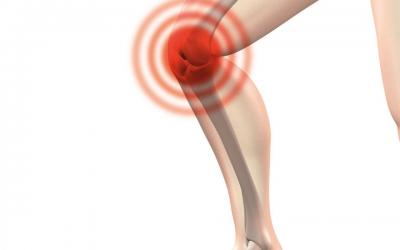 Il sovraccarico del ginocchio: scopri come affrontarlo con l’aiuto della Fisioterapia