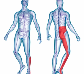 La Lombosciatalgia: come trattare la “sciatica” con la Fisioterapia